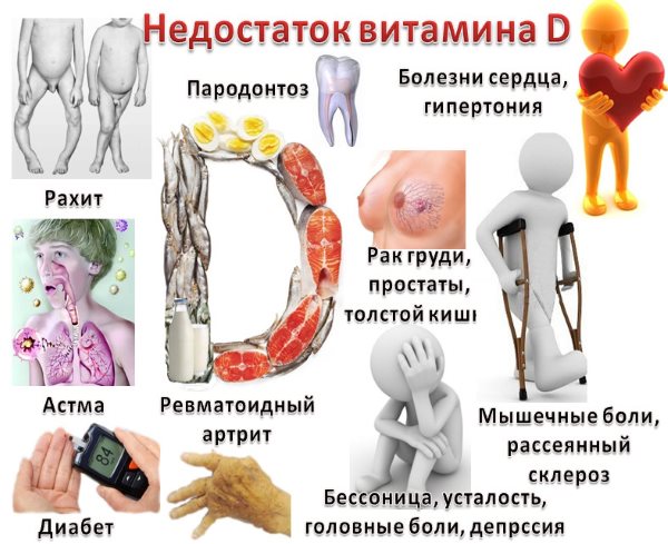 Consecințele deficitului de vitamina D.