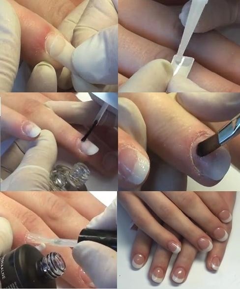 Extensão de unhas com gel em formulários. Instruções passo a passo com fotos, vídeo para iniciantes. Novo design 2024