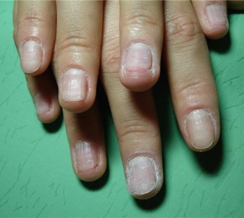 Manicure com bolhas - fotos, desenhos, como fazer unhas com bolhas, passo a passo