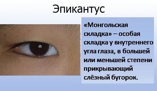 Formas dos olhos. Como identificar, foto e descrição, escolher flechas, fazer maquiagem perfeita