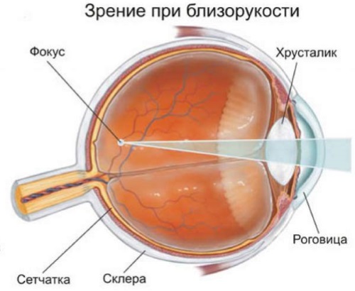 Sélection de lunettes en fonction de la forme du visage d'une femme pour la vision, la protection solaire. Règles. Actualités mode 2024