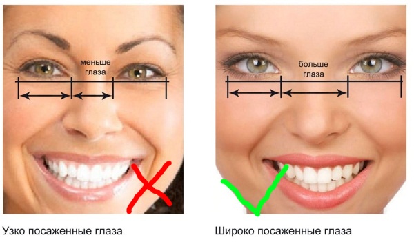 Efect de marionetă al extensiei genelor. Diagrama modului în care se face 2-3d, cine se potrivește, fotografie