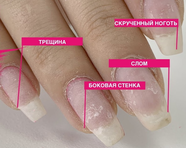 O que fazer se uma unha estiver quebrada, como consertá-la com esmalte de gel, estendida