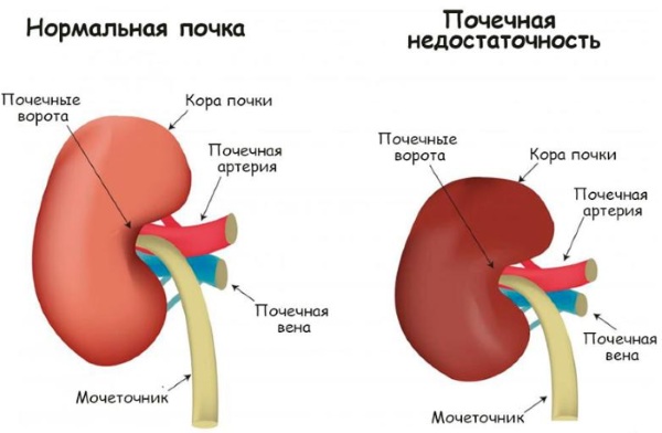 Tatuaj pentru sprâncene. Contraindicații, consecințe, vătămări în timpul sarcinii, menstruație, alăptare, diabet