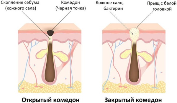 Art-Visage este un fond de ten permanent, hidratant, matifiant. Nuanțe, preț