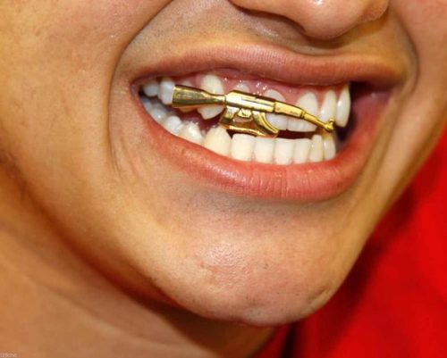 Grelha nos dentes. O que é isso, ouro, prata, diamante, branco. Preço