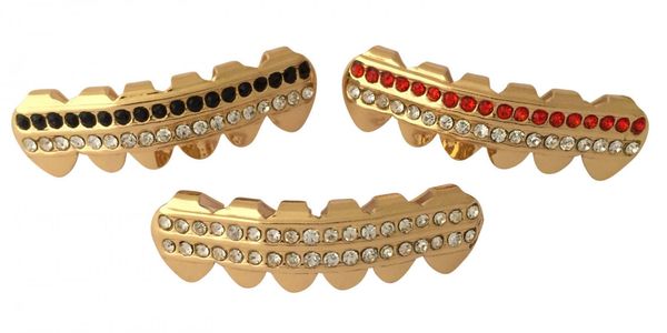 Grelha nos dentes. O que é isso, ouro, prata, diamante, branco. Preço