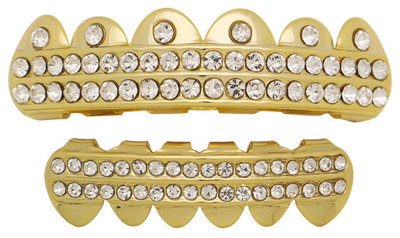 Grelha nos dentes. O que é isso, ouro, prata, diamante, branco. Preço