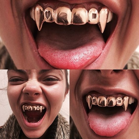 Grelha nos dentes. O que é isso, ouro, prata, diamante, branco. Preço