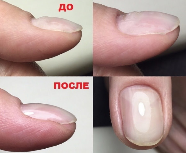 Camuflagem de manicure com lantejoulas. Foto de unhas lunares curtas e compridas, com strass, estrias